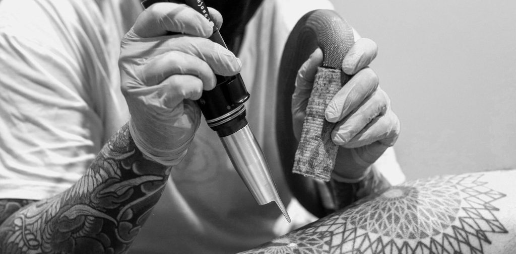 tattoo removal services