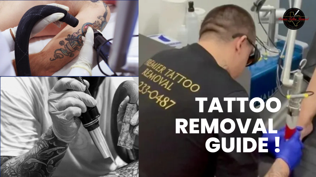 The Complete Guide to Safe and Effective Tattoo Removal in McKinney, Texas